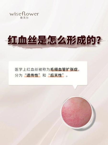 南昌高原红怎么治_南昌高原红会自愈吗