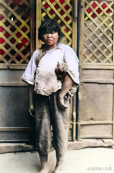 日本高原红小女孩_高原红成因