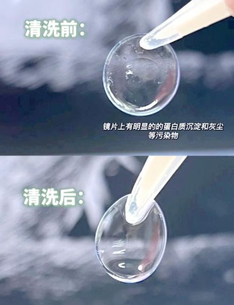 隐形眼镜高原能用吗_高原戴隐形眼镜注意事项