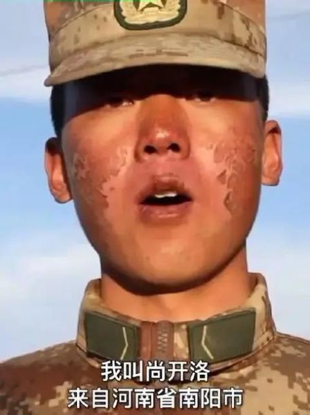 高原紫外线强怎么办_高原紫外线对皮肤伤害