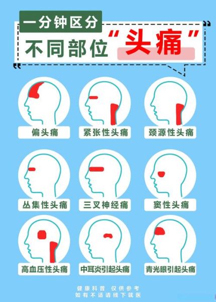 头痛是不是高原反应_高原头痛怎么判断