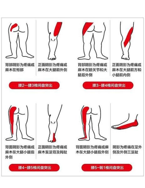 高原腰疼怎么办_高原旅行腰疼原因