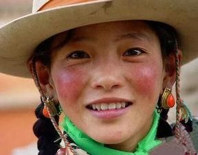 高原反应会过敏吗_高原过敏症状有哪些