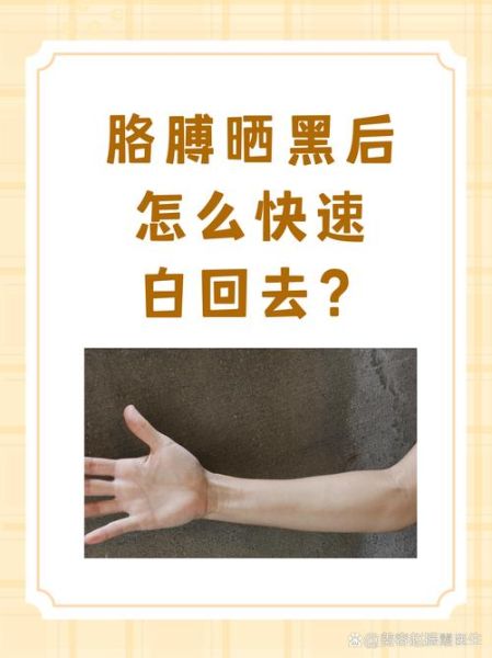 高原晒黑了怎么办_高原晒黑多久能恢复