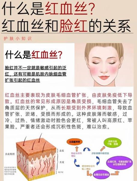 新疆会有高原红吗_高原红成因与预防