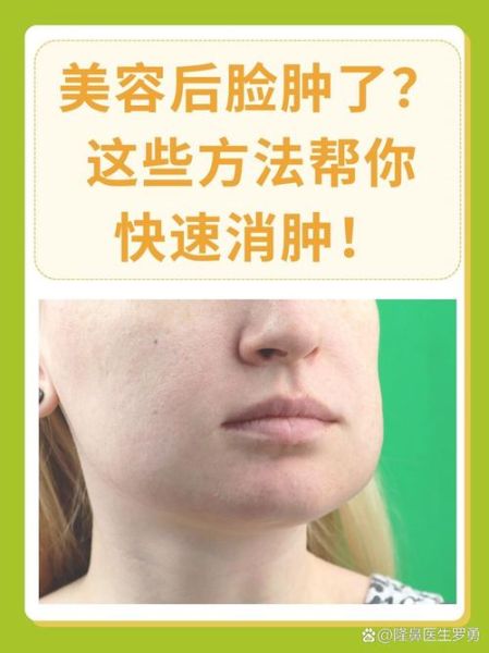 高原反应脸肿怎么办_高原脸肿如何快速消肿