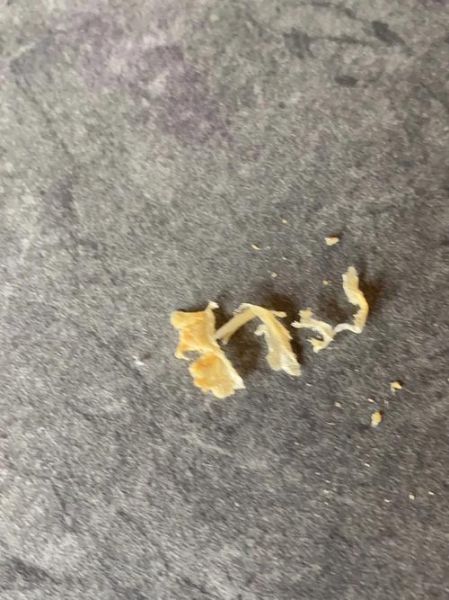 高原耳背是怎么回事_高原耳背多久能恢复