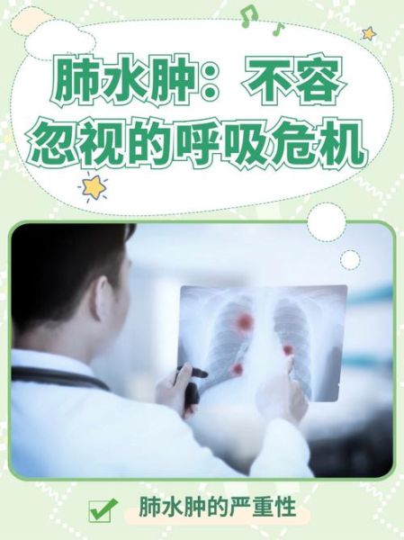 高原咳嗽肺水肿怎么办_如何预防