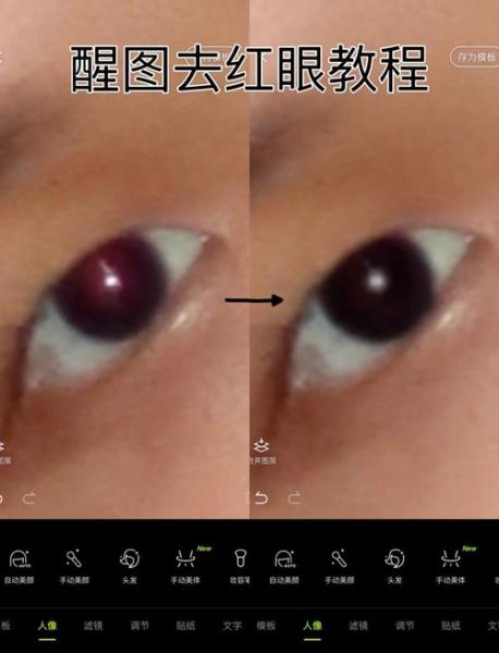 高原地区眼纹怎么消除_高原红眼纹能恢复吗